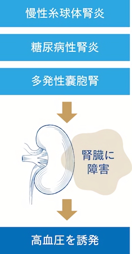 腎臓にかかわる病気が高血圧の要因になることも