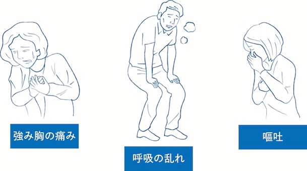 心筋梗塞の主な症状