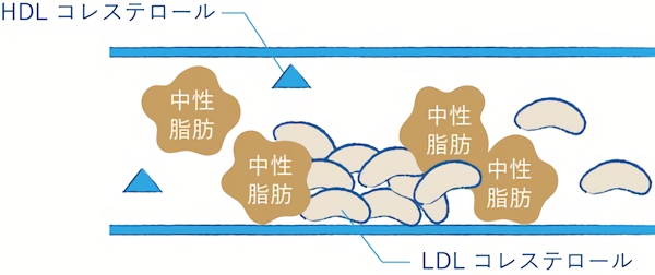 中性脂肪の増加がHDLコレステロール減少を招く